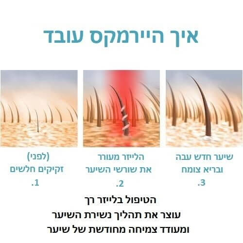 תמונה של מברשת לייזר לטיפול בנשירת שיער והתקרחות hairmax
